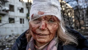 bir fotografla sohret olan ukraynali kadin abdye lanet okuyor O1uL7iME