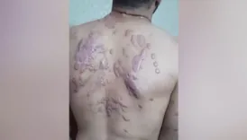 dunya israilin filistinlilere yaptigi iskenceleri seyrediyor u3NtCPEJ