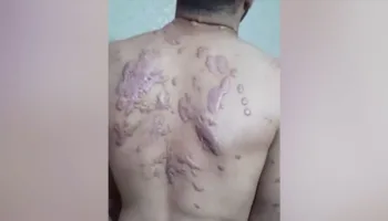 dunya israilin filistinlilere yaptigi iskenceleri seyrediyor u3NtCPEJ