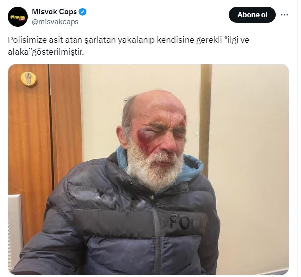polise asit atan saldirganin yakalandigi one suruldu 0 4jmyUN5Y