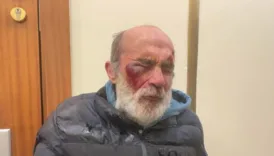 polise asit atan saldirganin yakalandigi one suruldu Ajs2Slsb