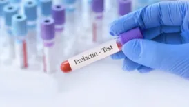 prolaktin nedir vucutta ne ise yarar prolaktin dusuklugu ve yuksekligi nasil anlasilir nedenlerdir ErZLWj6T