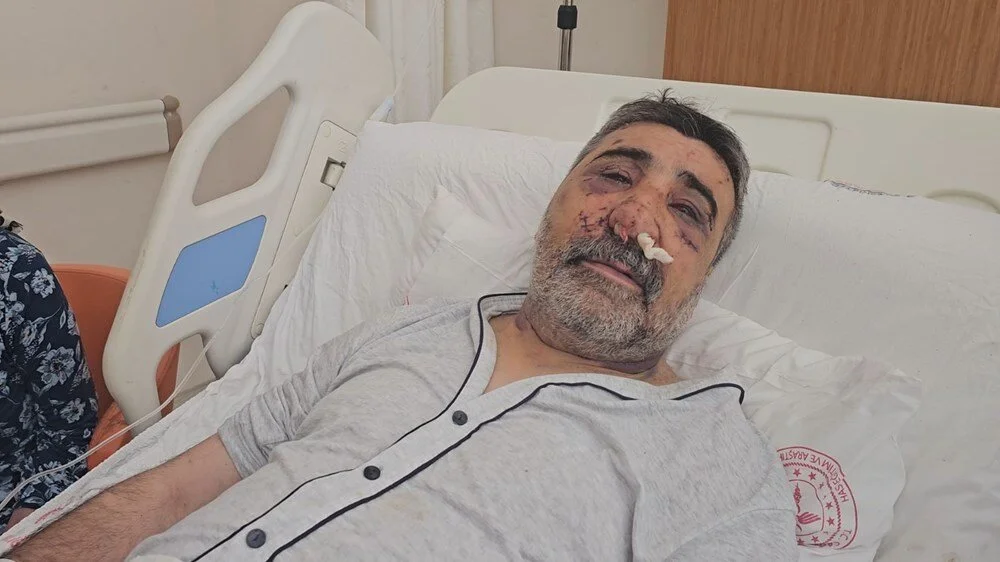 ingiliz boksorun dovdugu taksici konustu optu isirdi elini gozume soktu 1 cqAMZy92