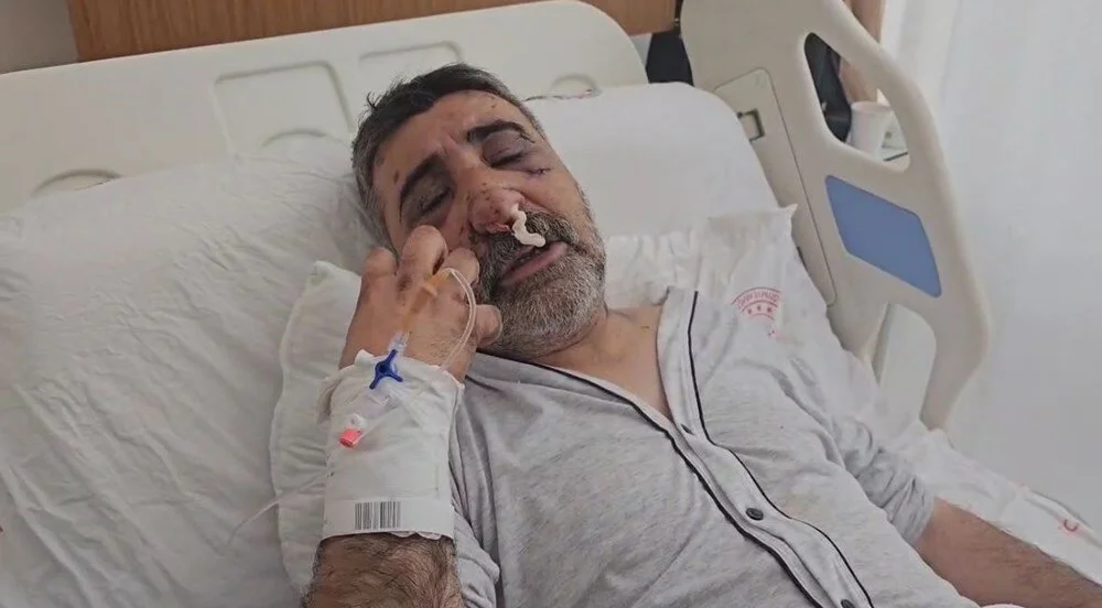ingiliz boksorun dovdugu taksici konustu optu isirdi elini gozume soktu 2 rJgSe5m1
