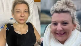 ingiliz kadinin estetik kabusu yagli halimle daha guzeldim IkkHOfdZ